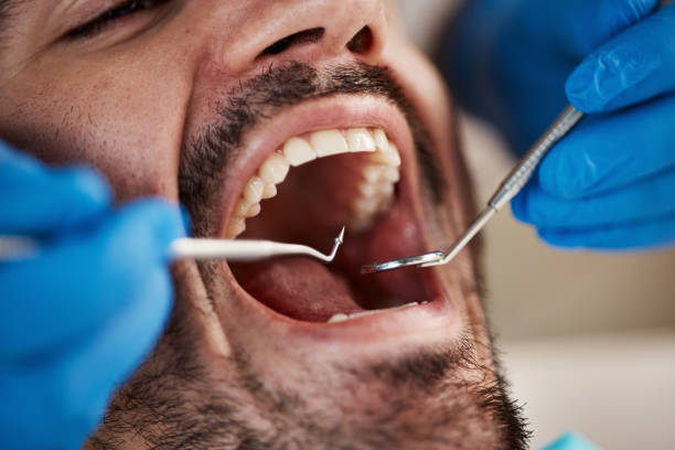Best Urgent Care for Lost Fillings or Crowns in Filer, ID